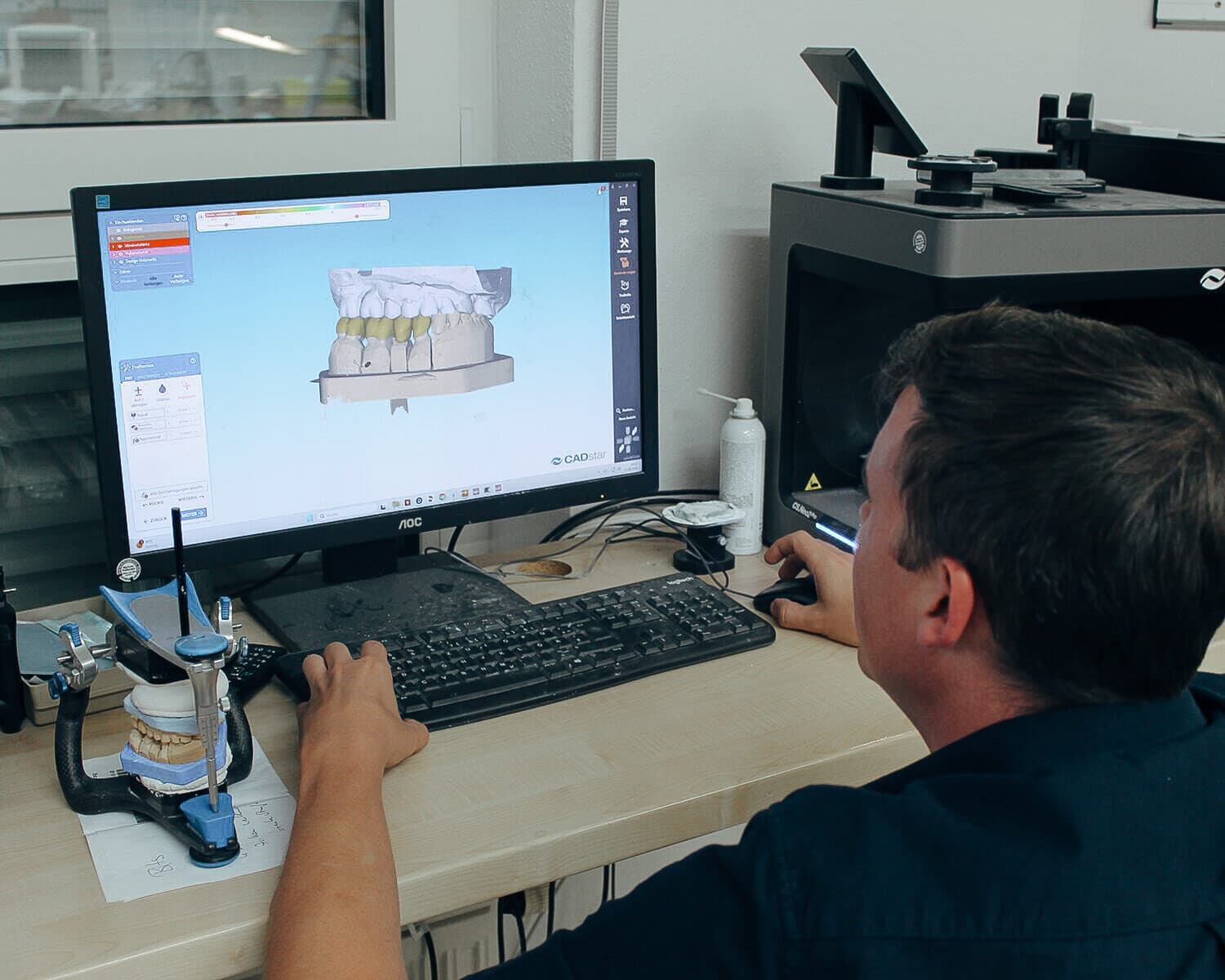 CAD/CAM-gestützte Planung