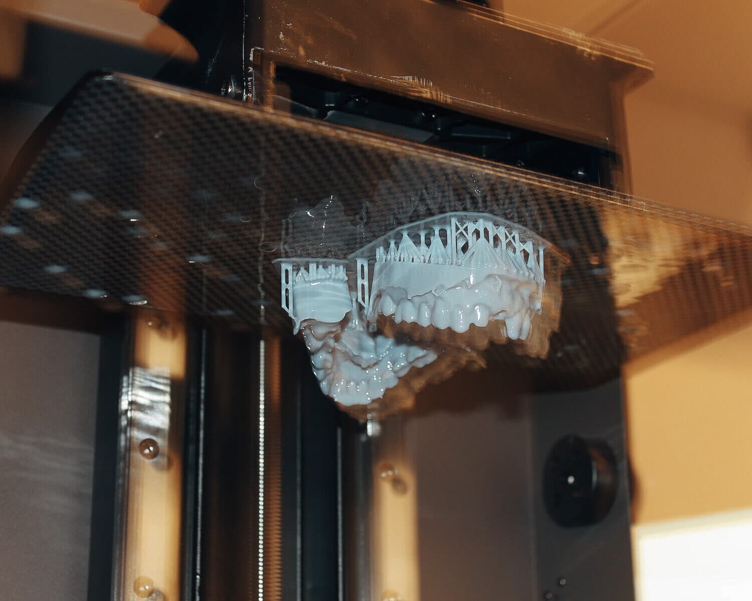 CAD/CAM-Präzision