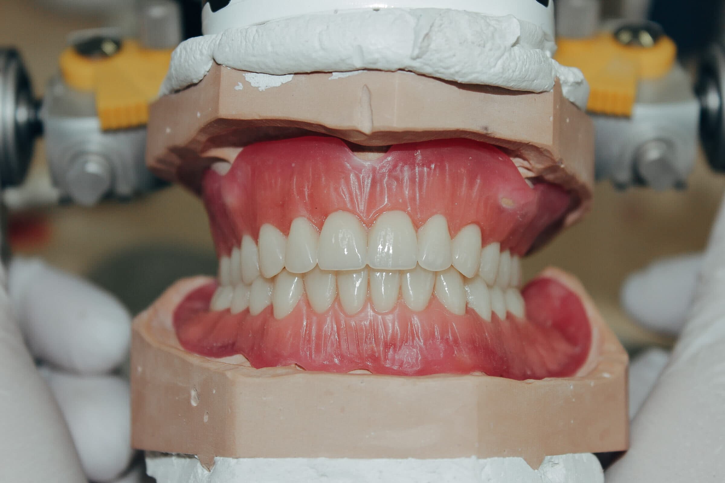 Provisorium aus dem Dentallabor