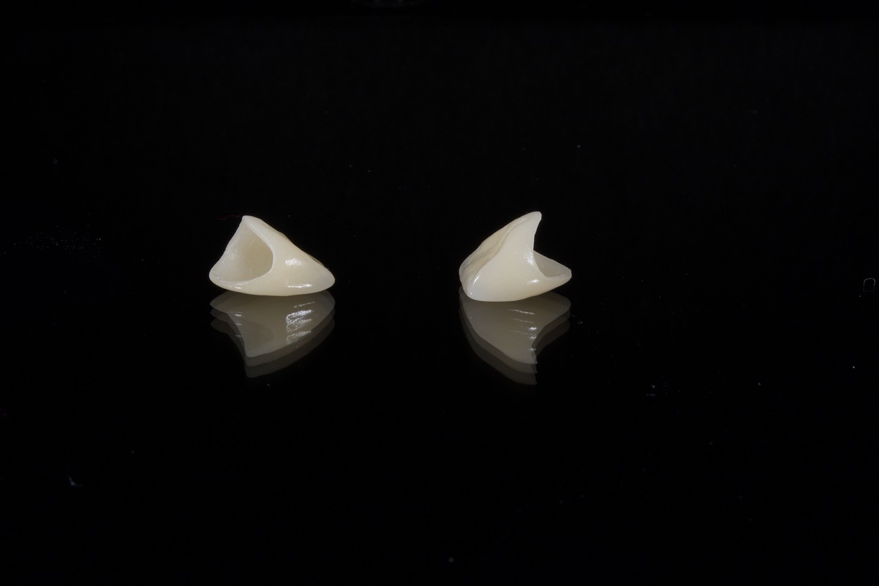 dental-2036941_1280
