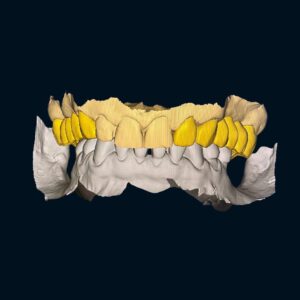 Beige Minimalist Before After Hair Salon Instagram Post